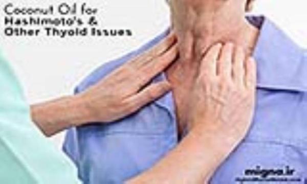 علائم تورم غده تیروئید علائم تورم غده تیروئید