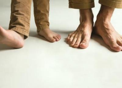 روش تشخیص کف پای صاف در بچه ها ، صافی کف پا تا چه سنی قابل درمان است؟ ، علائم صاف بودن کف پا و راه های درمان آن